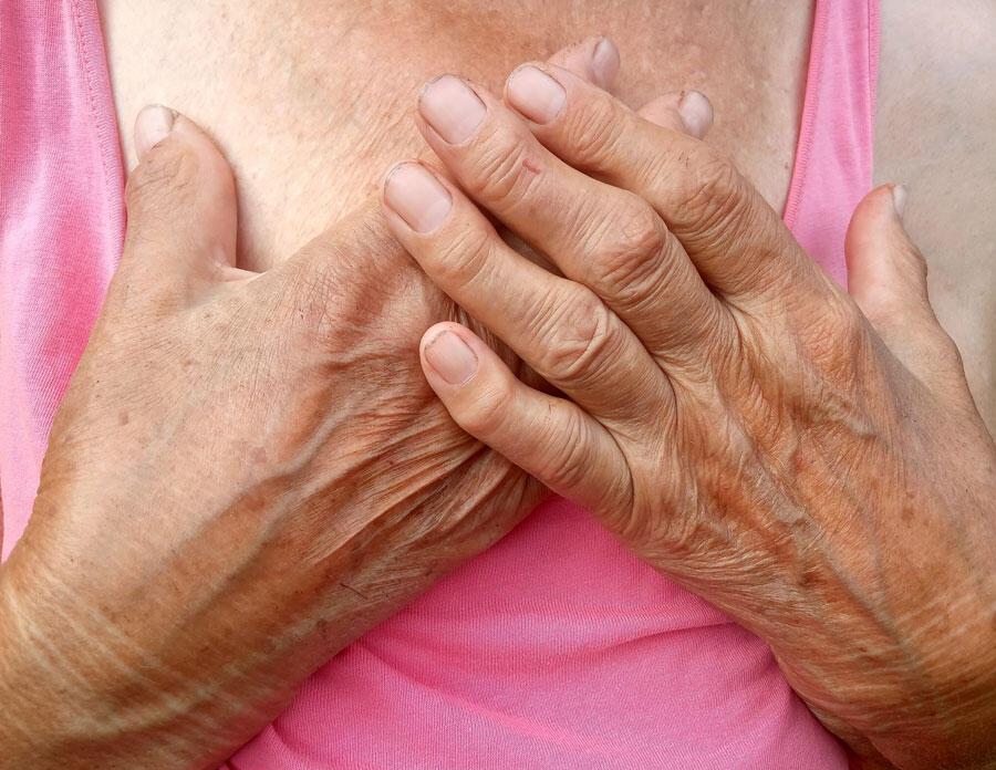 Deux mains de femme âgée posées sur sa poitrine et dont les doigts sont déformés.