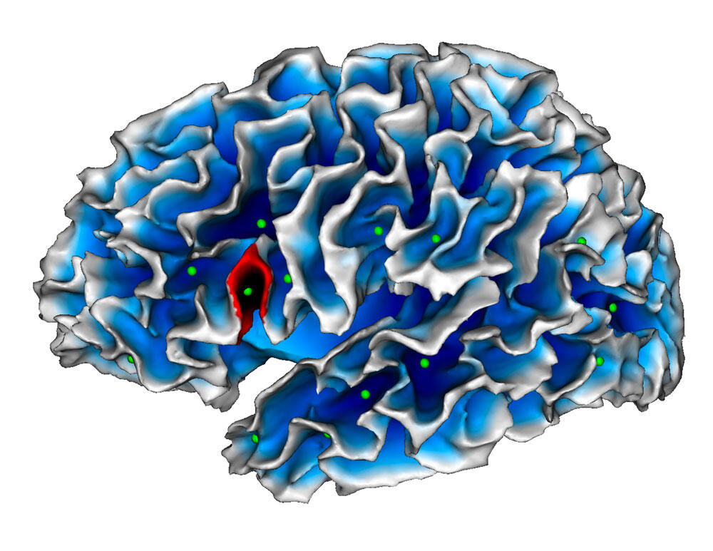 © Lucile Brun / Équipe SCALP / INT / CNRS Images 