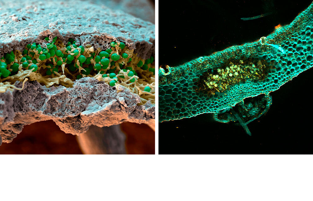 ©Eye of Science / SPL ; © Aurélie Le Ru, plateforme d'imagerie TRI-FRAIB et Nicolas Vigneron Caloplaca © Eye of Science / SPL ; Marchantia © Aurélie Le Ru, plateforme d'imagerie TRI-FRAIB et Nicolas Vigneron