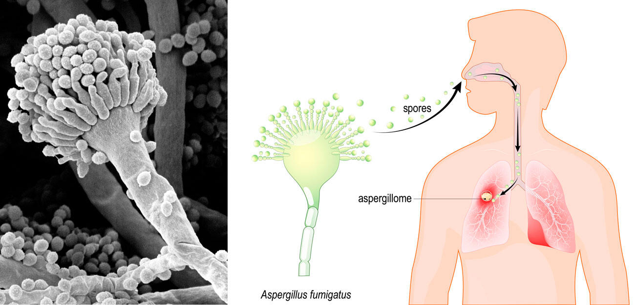 ©Image David Gregory & Debbie Marshall via Wellcome Collection CC BY 4.0 - Schéma © Designua / shutterstock.com Image David Gregory & Debbie Marshall via Wellcome Collection CC BY 4.0 - Schéma © Designua / shutterstock.com