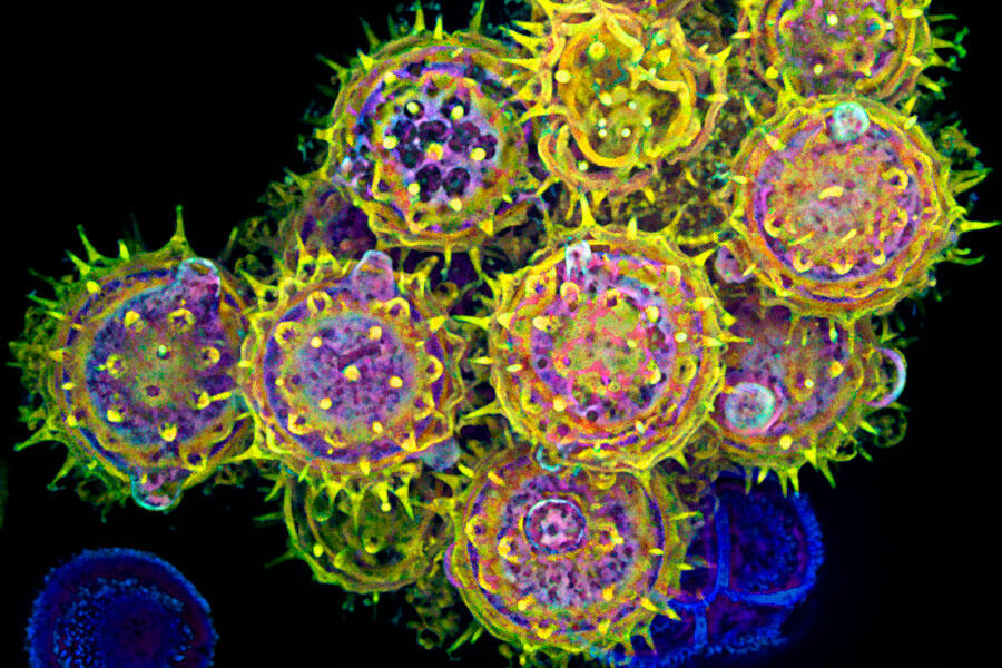 grains de pollen vus au microscope et colorisés © NIH / Edna, Gil and Amit Cukierman, Fox Chase Cancer Center, Philadelphia, PA