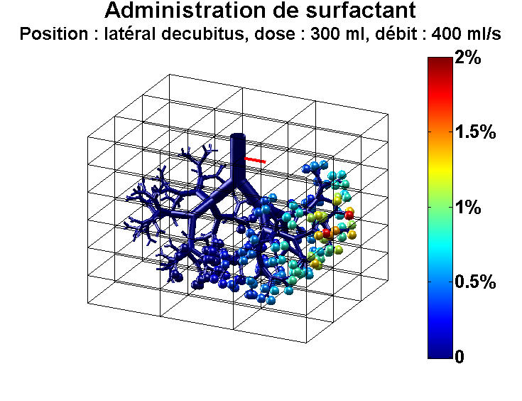 Répartition de surfactant dans les bronches