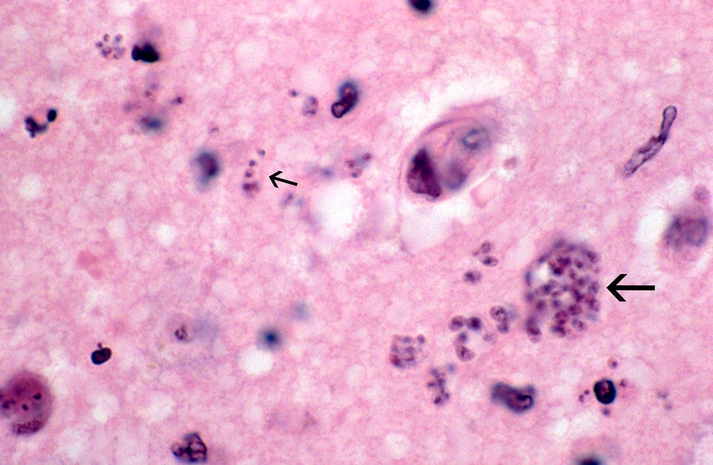 Des tachyzoites (petite flèche) qui ont pu sortir du kyste à droite (grande flèche)