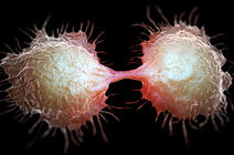Cellule de cancer du côlon en train de se diviser en deux
