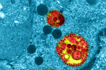 image en microscopie de l'infection de cellules épithéliales humaines par le virus SARS-CoV-2