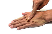 ©Onandter_sean / iStockphoto.com un doigt appuie sur le dos d'une main, créant des plis de peau