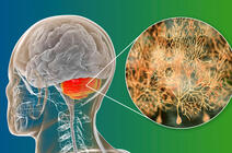Illustration localisant le cervelet et les cellules de Purkinje © Dr_Microbe/iStock