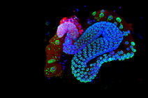 Appareil reproducteur du ver Caenorhabditis elegans vu en microscopie confocale à fluorescence.