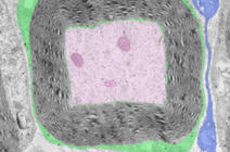 © INSERM, Nicolas Tricaud, Institut des Neurosciences de Montpellier