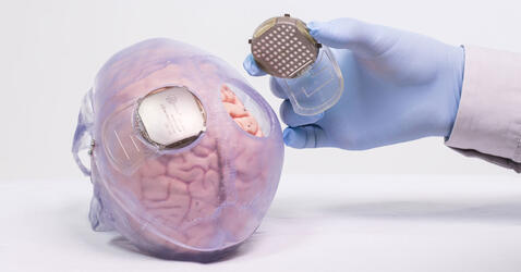Implant Wimagine par Clinatec