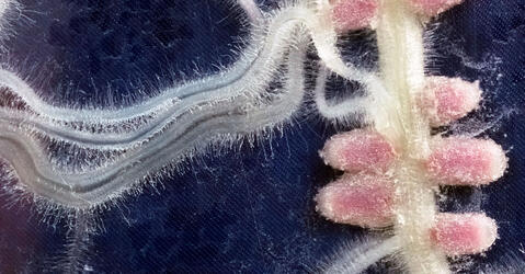 Exemple de symbiose : gros plan sur les nodules (rose) formés par des bactéries sur les racines d’une légumineuse 