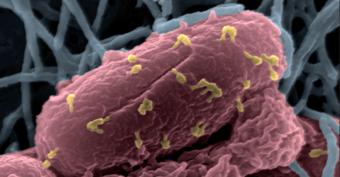 Image en microscopie électronique à balayage colorisée d'une bactérie attaquée par des bactériophages