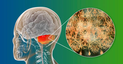 Illustration localisant le cervelet et les cellules de Purkinje © Dr_Microbe/iStock