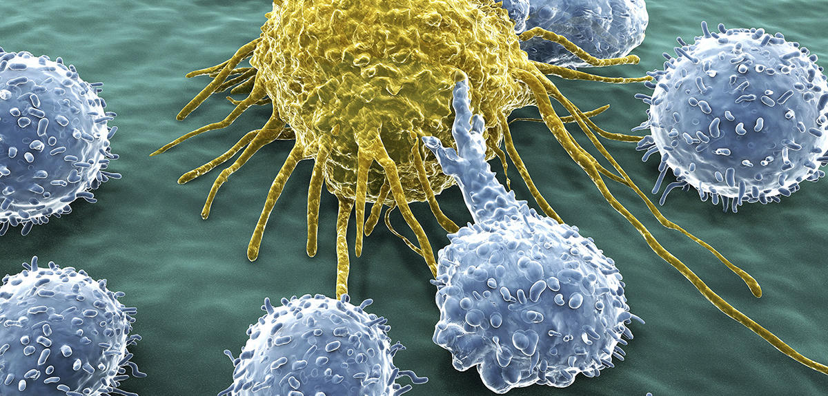 Lymphocytes attaquant une cellule cancéreuse