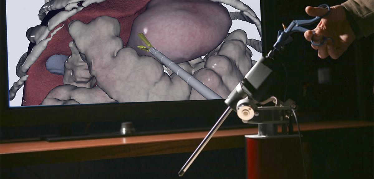 Simulation d'une laparoscopie avec retour d'effort.