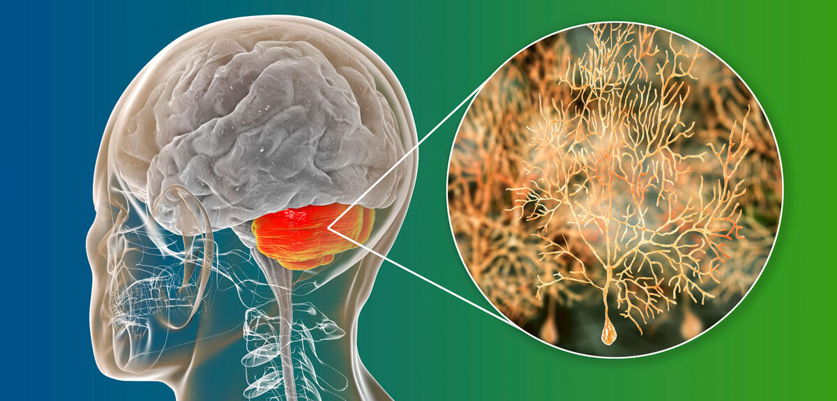 Illustration localisant le cervelet et les cellules de Purkinje © Dr_Microbe/iStock