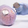 ©LaBreche / Clinatec Implant Wimagine par Clinatec