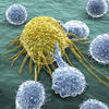 Lymphocytes attaquant une cellule cancéreuse