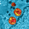 image en microscopie de l'infection de cellules épithéliales humaines par le virus SARS-CoV-2