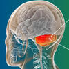 Illustration localisant le cervelet et les cellules de Purkinje © Dr_Microbe/iStock